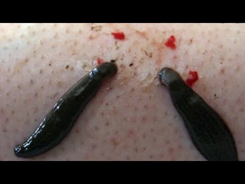 Sports media parasites….